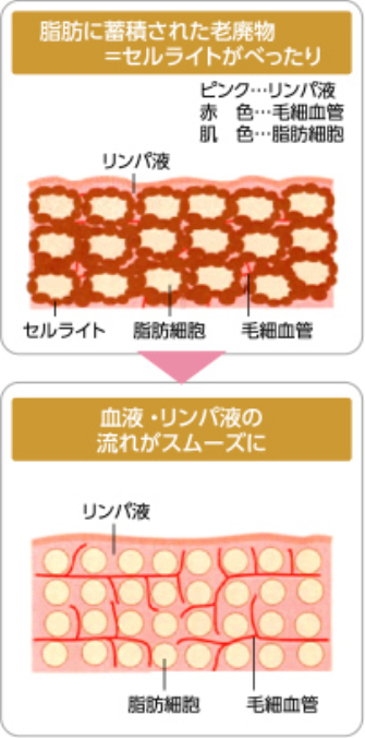 キャビテーションの特徴